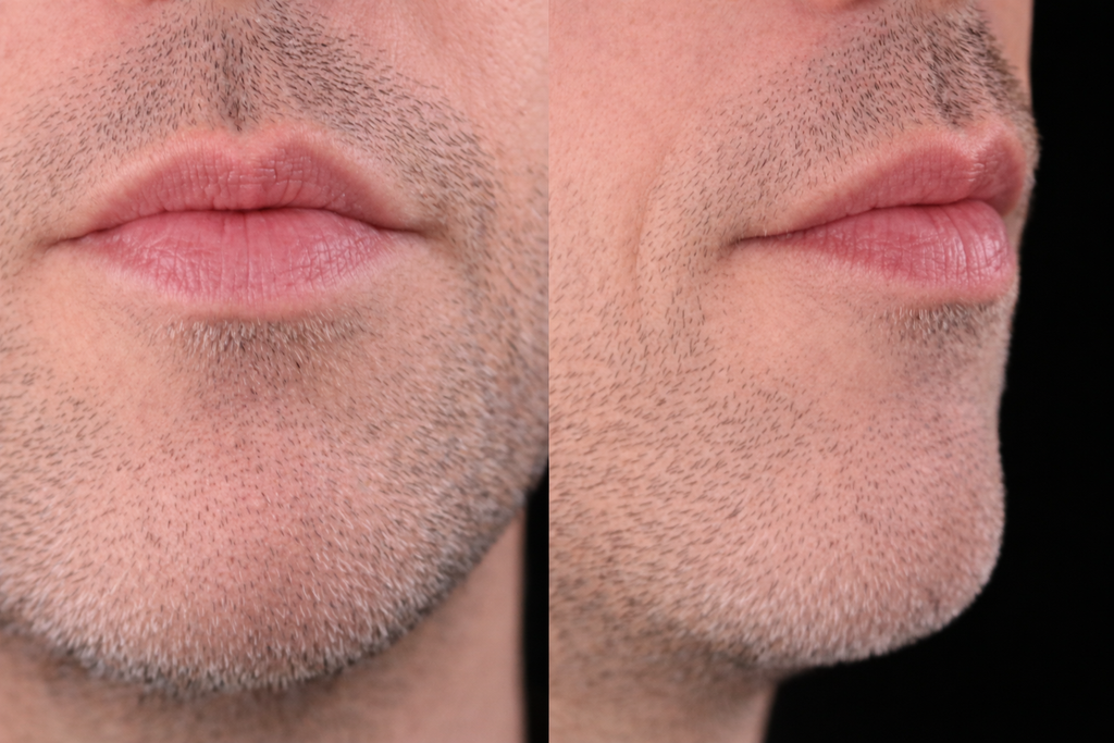 Lip shape shared by bat and pat