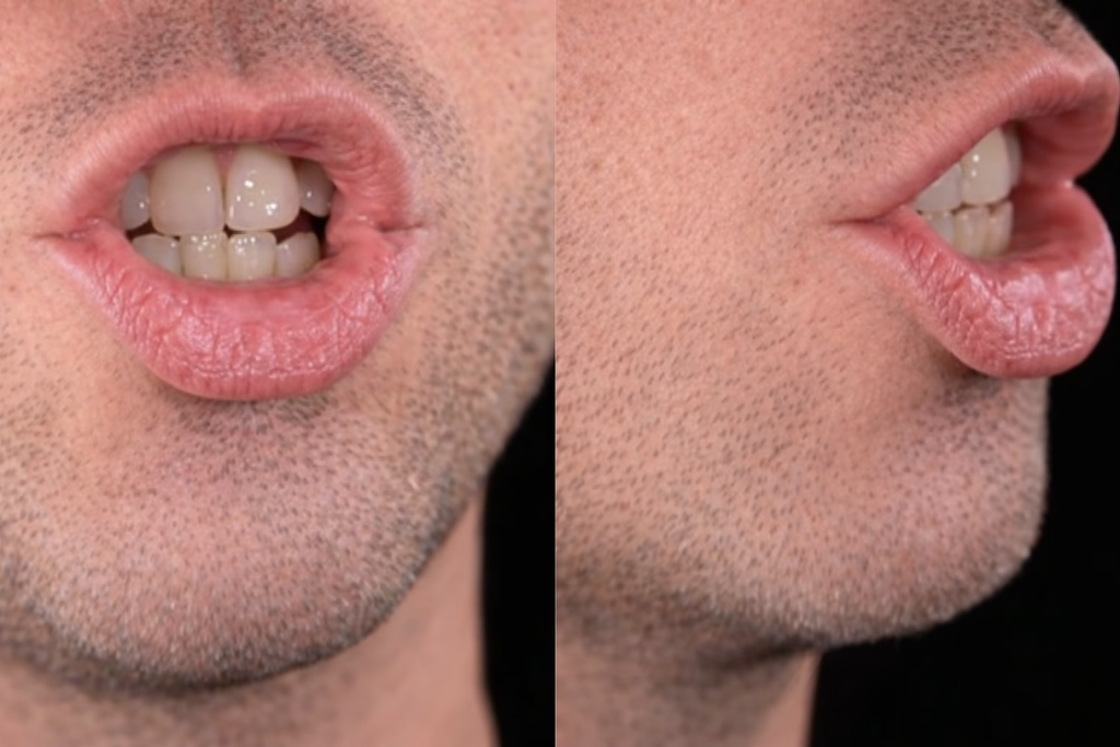 Mouth position for /tʃ/ in chip