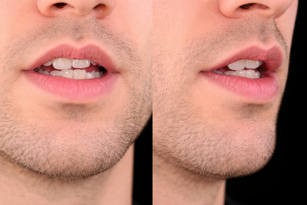Lip shape shared by dip and tip