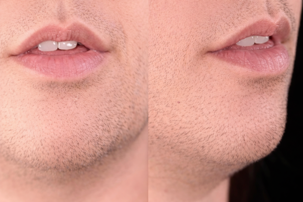 Mouth position for /θ/ in think