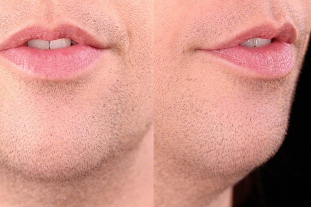 Mouth position for /v/ in very
