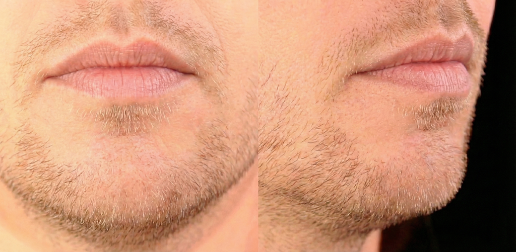 Mouth position for /m/ in sum