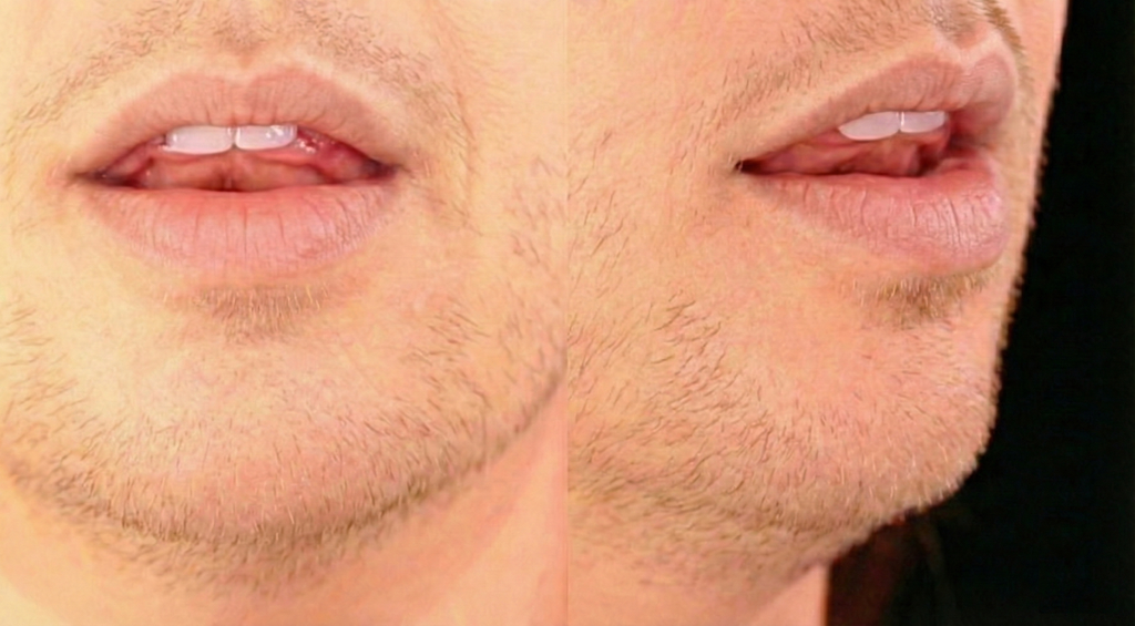Mouth position for /n/ in sun