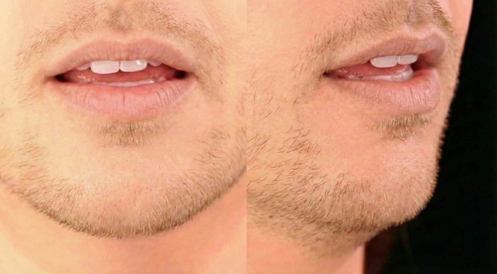 Mouth position for /ŋ/ in sing