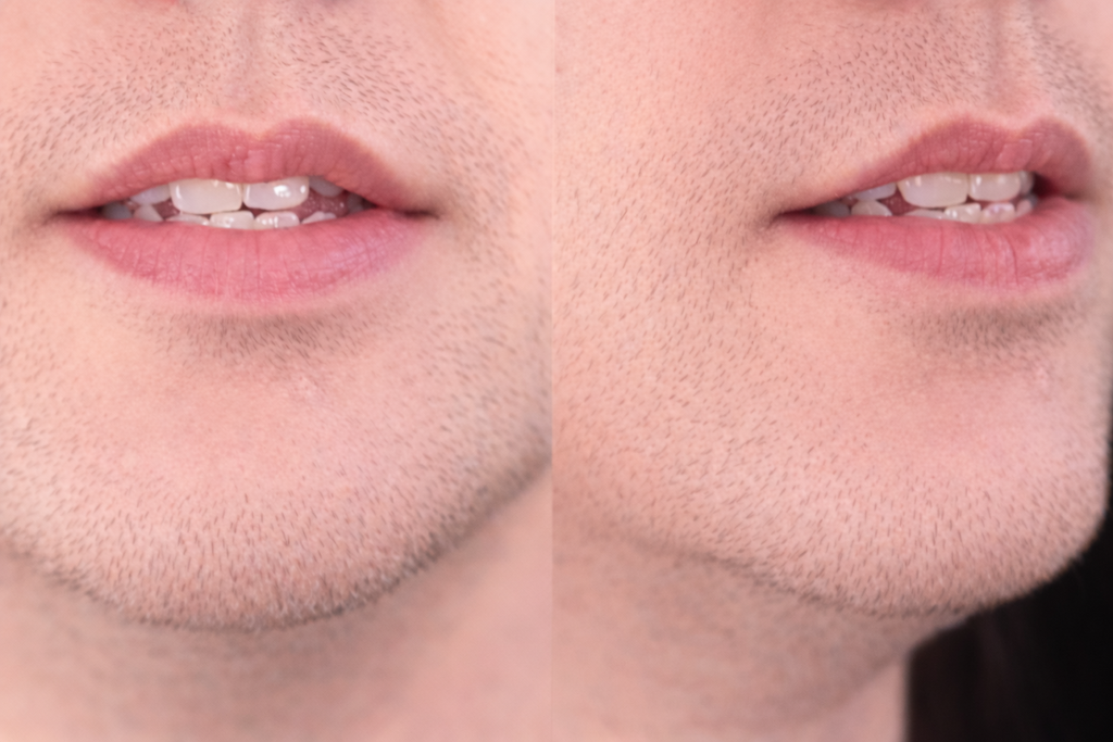 Mouth position for /s/ in seat