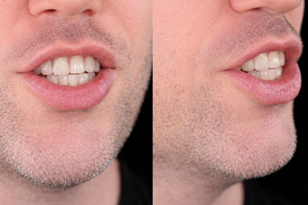 Mouth position for /ʃ/ in ship