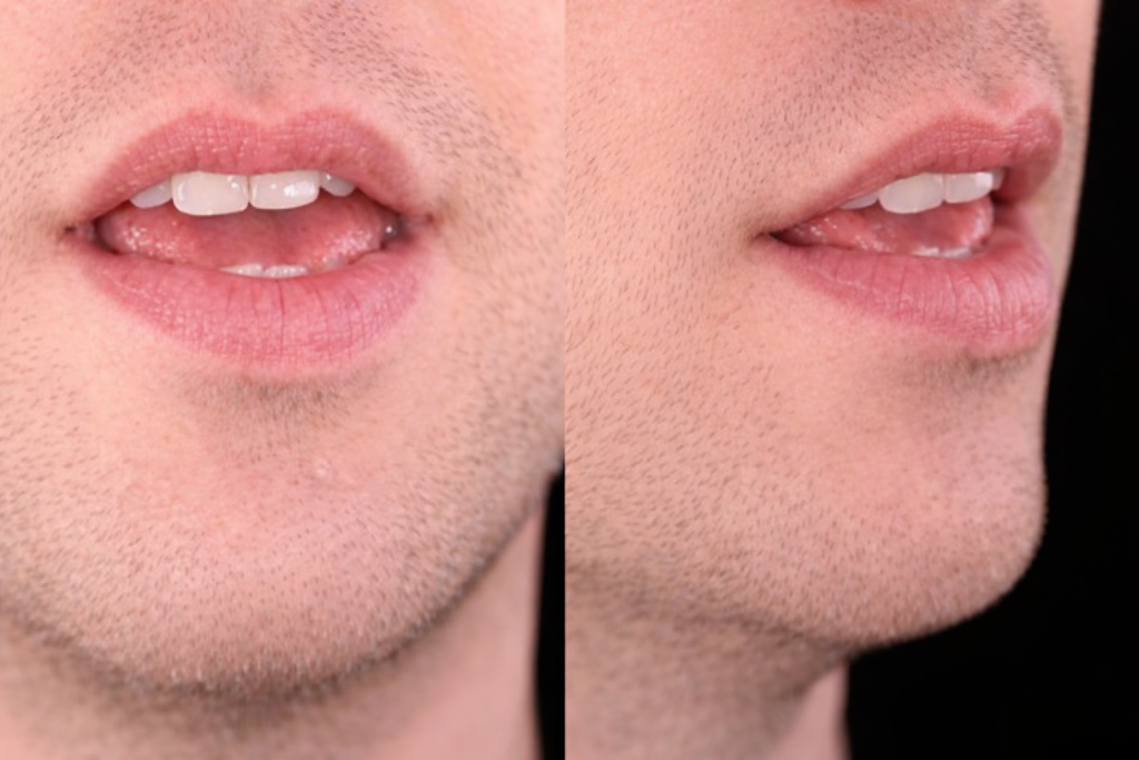 Mouth position for /j/ in yet