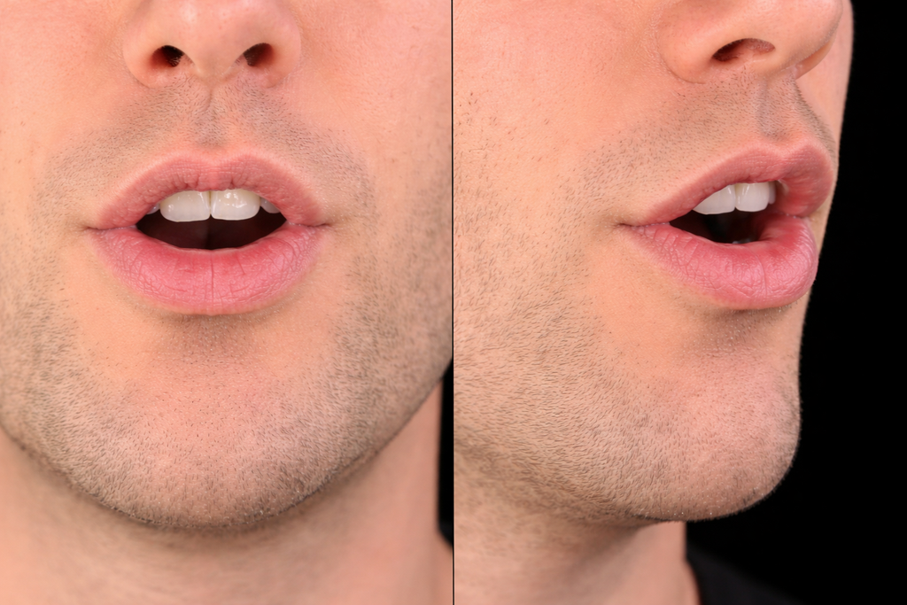 Mouth position for /ər/ in letter