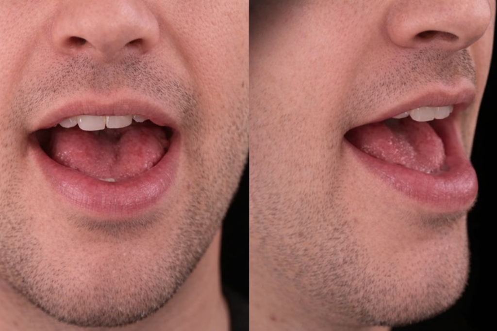 Mouth position for /æ/ in cat