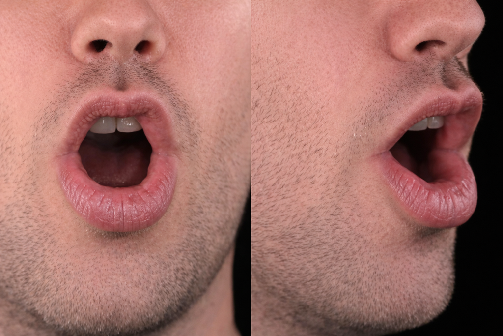 Mouth position for /ɔ/ in caller