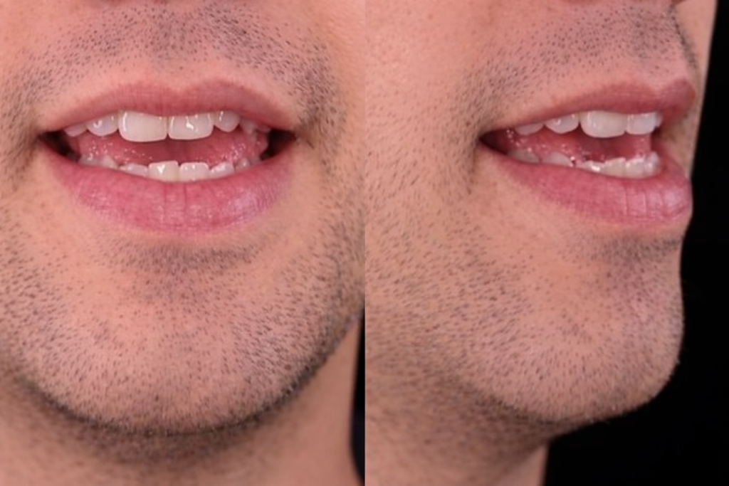 Mouth position for /i/ in seat