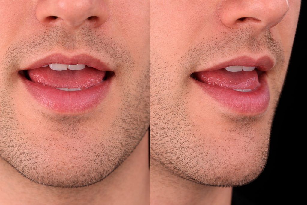 Mouth position for /ɪ/ in sit